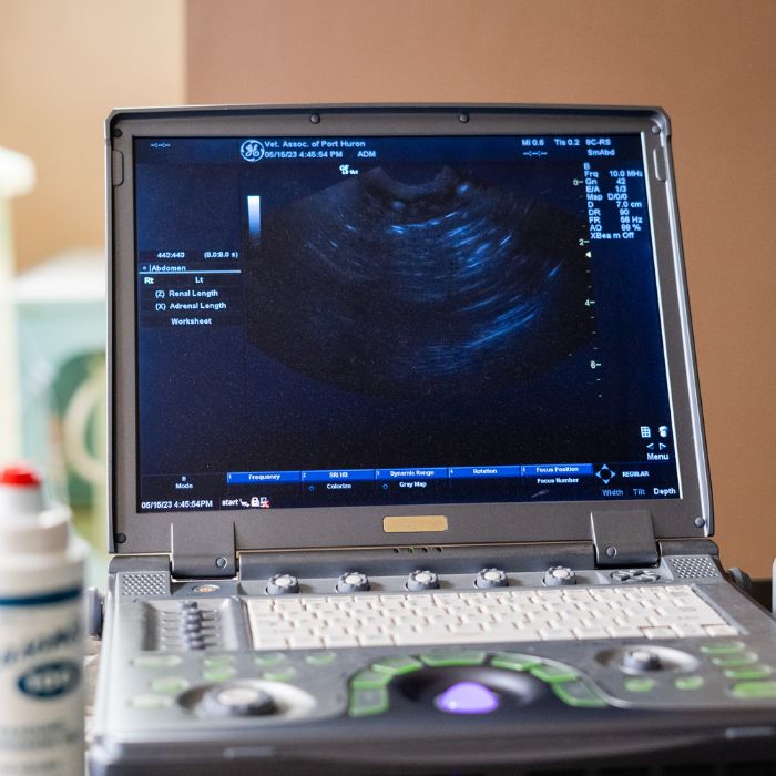 Ultrasonography equipment